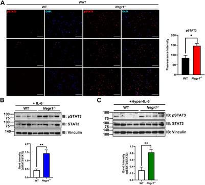 Neuronal growth regulator 1 may modulate interleukin-6 signaling in adipocytes